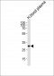 C1QA Antibody (Center)
